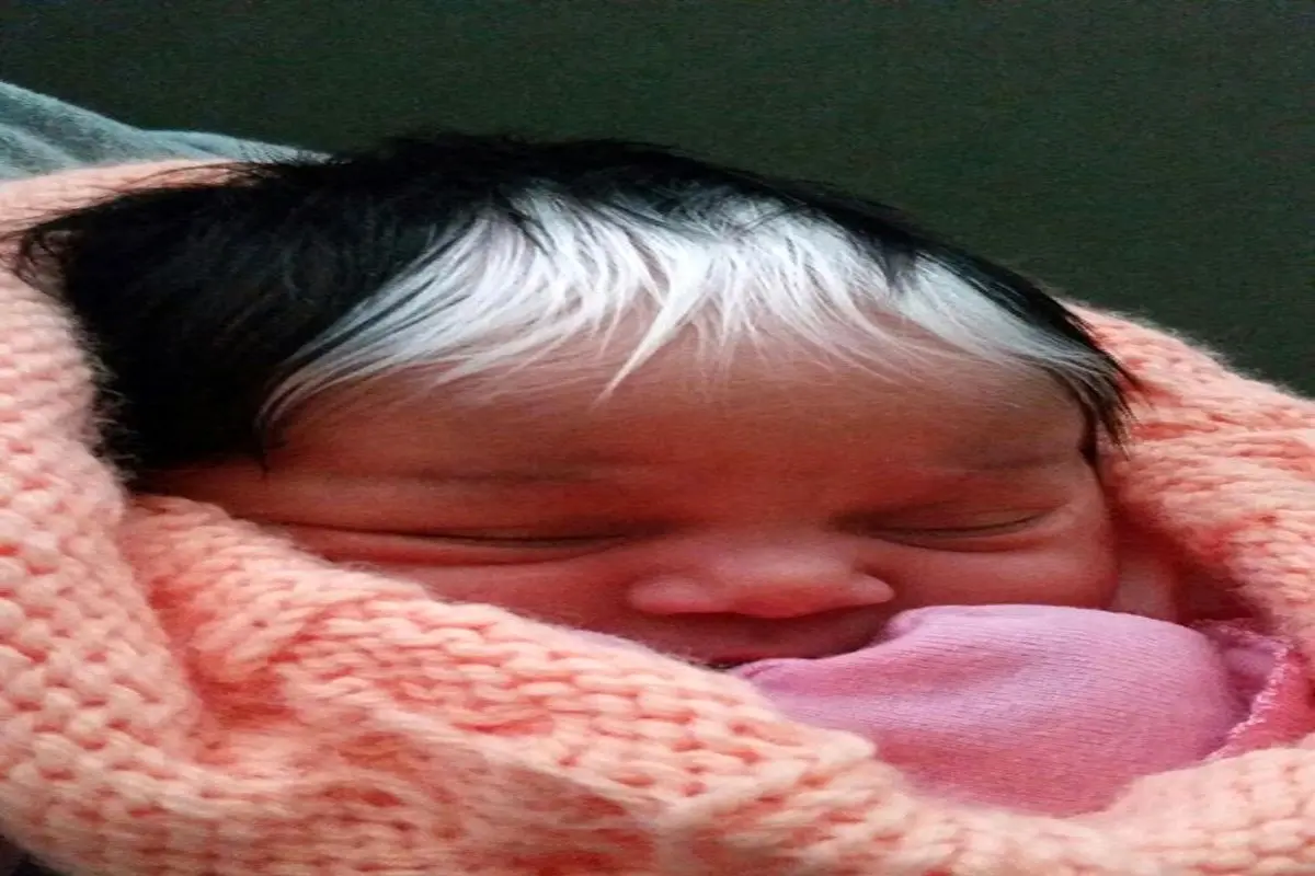 این نوزاد با موهای سفید بدنیا آمد +تصاویر