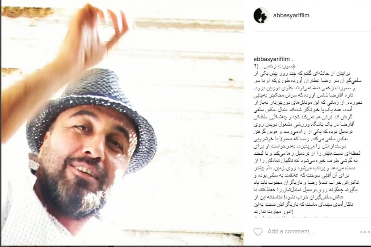زخمی شدن رضا عطاران در اثر سلفی گرفتن +عکس