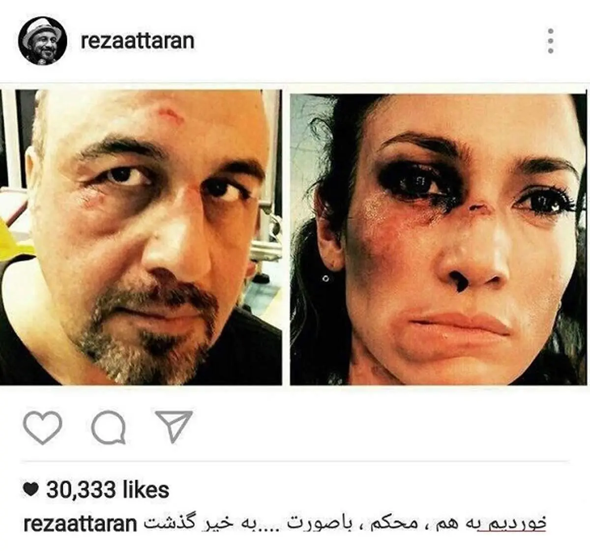 برخورد رضا عطاران با جنیفر به‌خیر گذشت +عکس