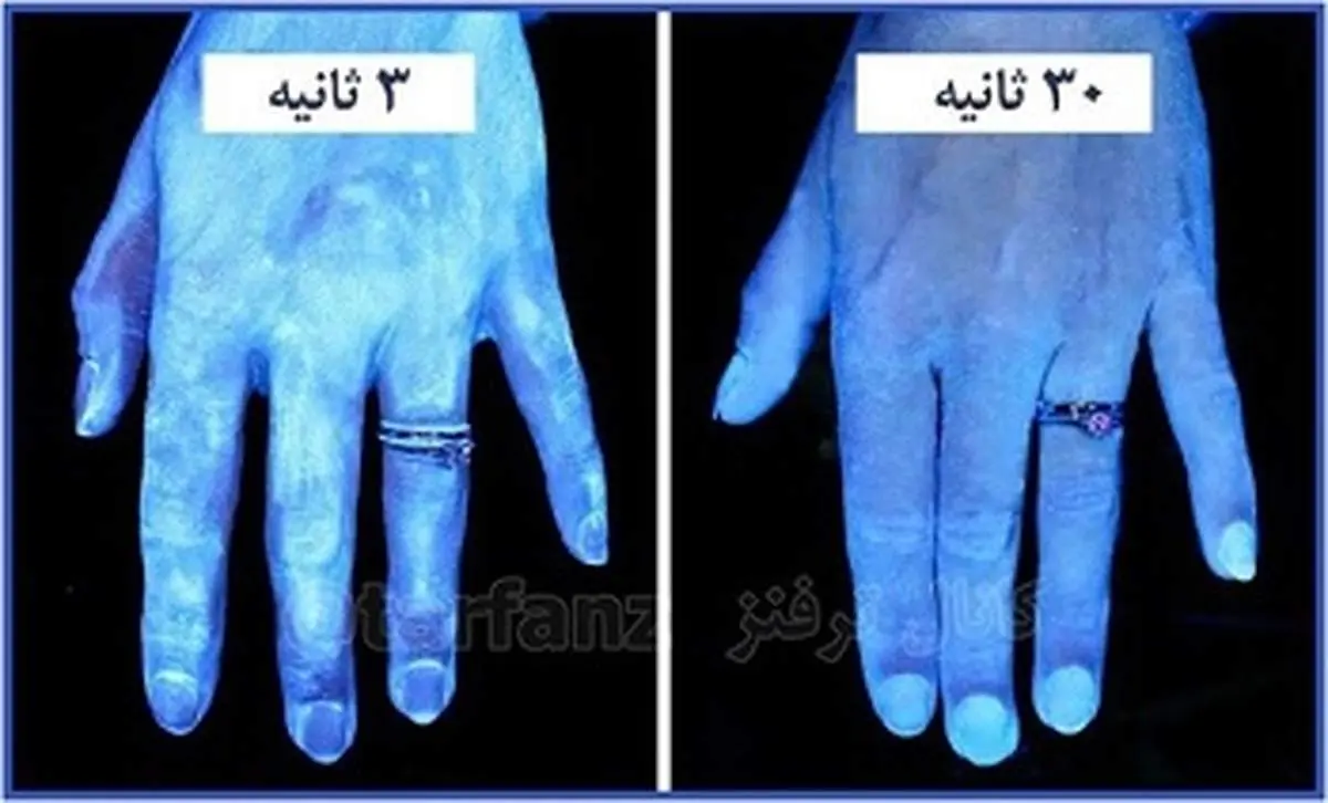 میکروبهای کف دست خود را تاکنون دیده اید؟