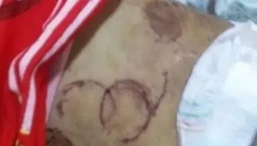 پدری بدن دخترش را گاز گرفت +عکس