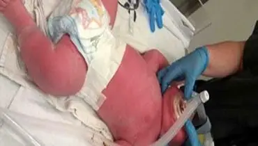 تولد نوزاد هفت کیلویی در نیوزیلند +عکس
