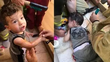 دست کودک در کف شور گیر کرد +عکس