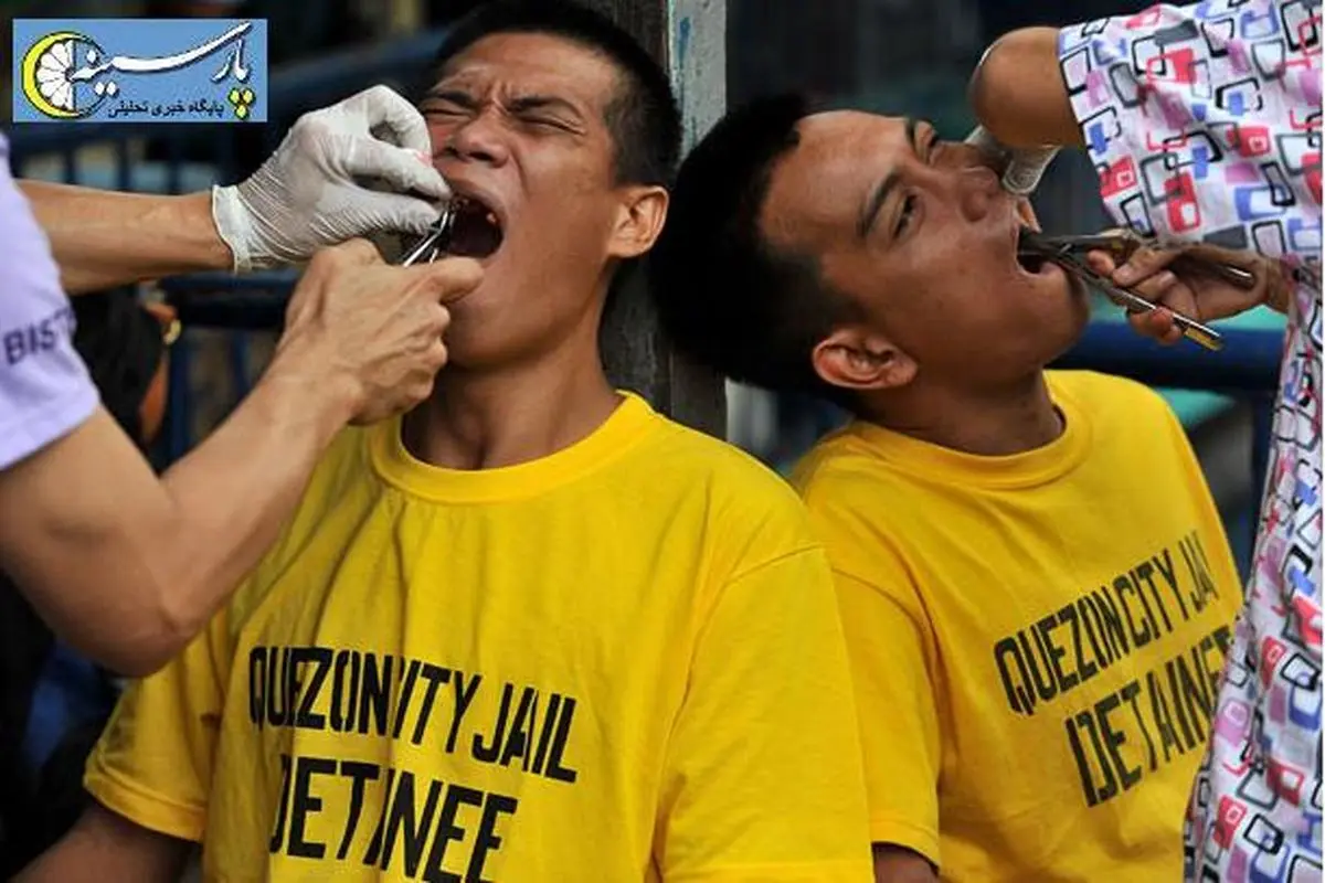 عکس:دندان کشیدن در زندان
