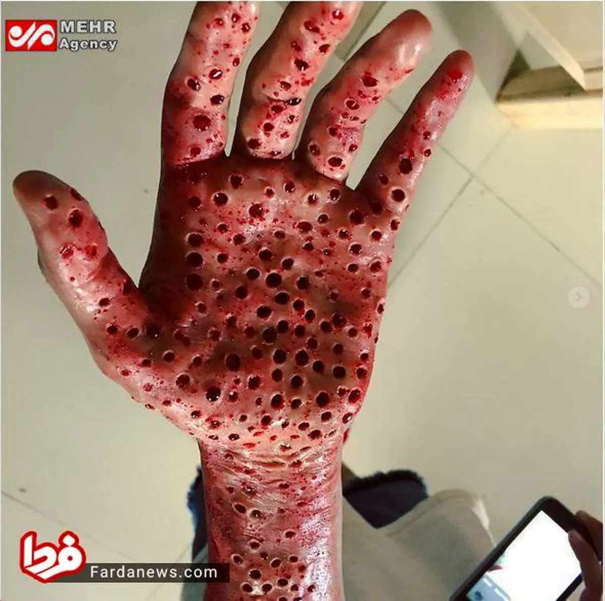 گریم چندش‌آور یک دانشجو برای دریافت بورسیه
