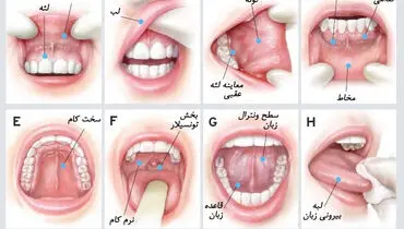 زخم در دهان نشانه چیست؟