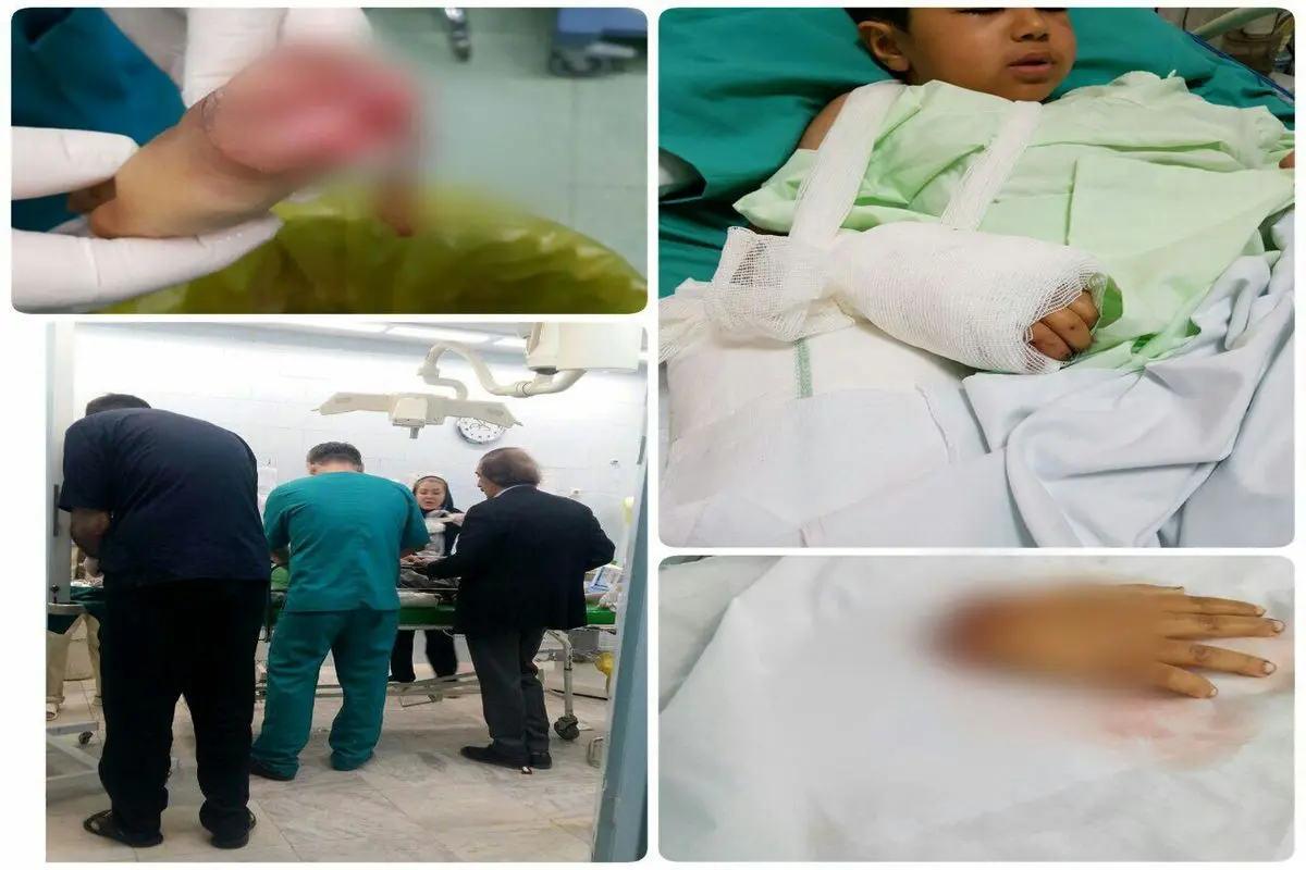پیوند دست قطع شده کودک زلزله زده+عکس