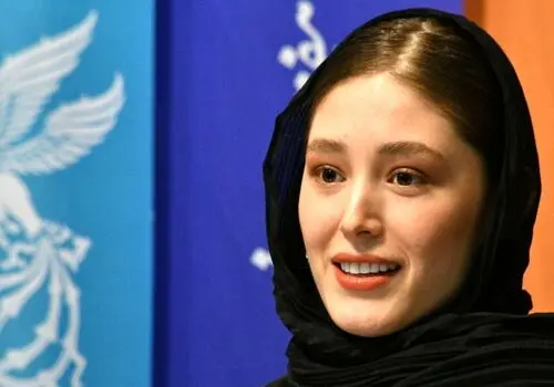 عکسی تعجب آور از فرشته حسینی با صورت کتک خورده