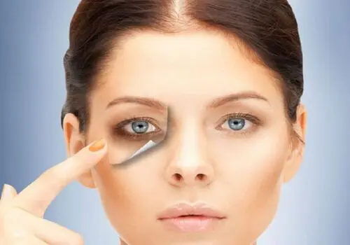 علت سیاهی دور چشم و روش‌های رفع آن
