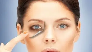 روش خانگی از بین بردن تیرگی دور چشم