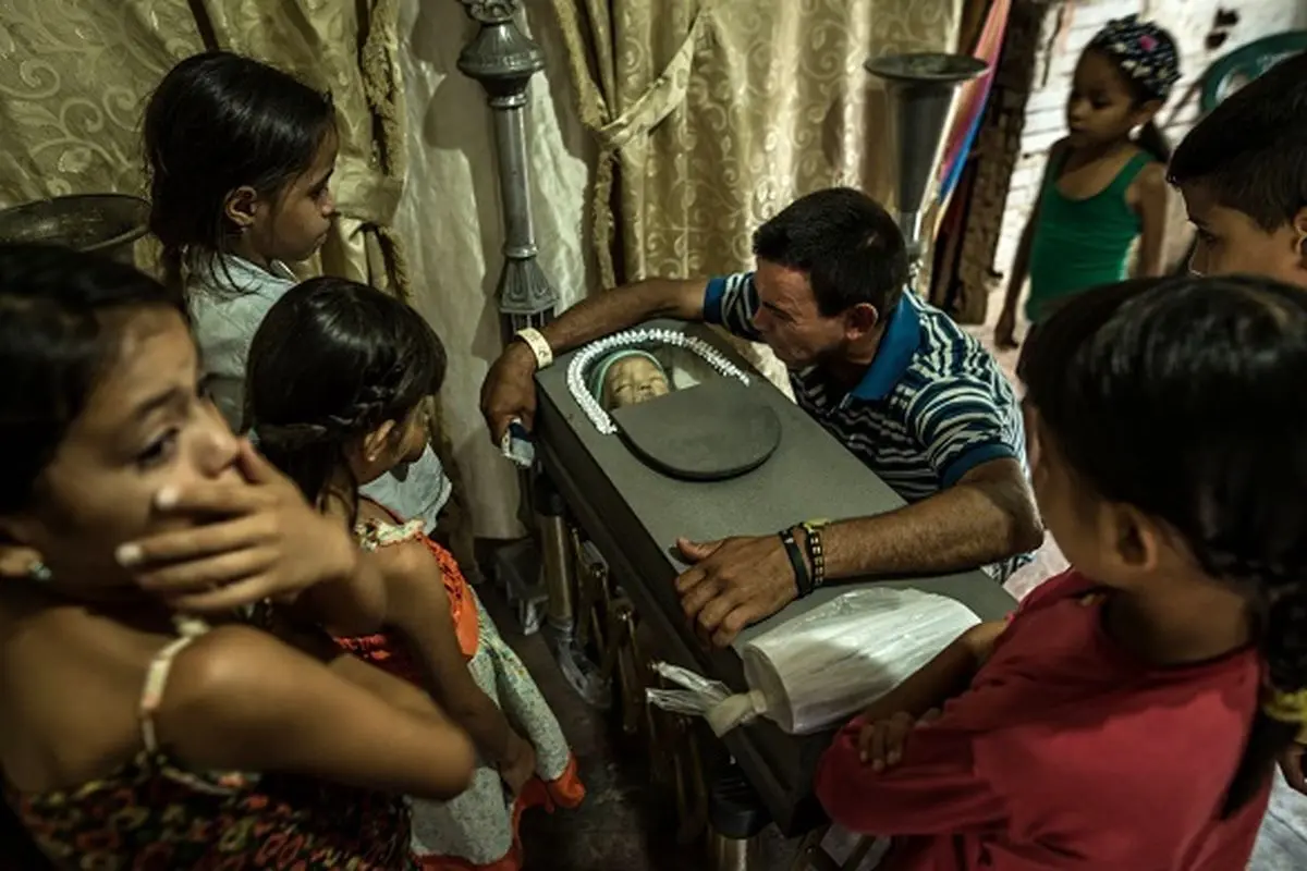 مرگ بی‌سابقه کودکان ونزوئلایی بر اثر گرسنگی ناشی از بحران