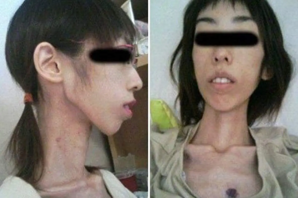 شکنجه دختر ژاپنی با کاهش وزن! +عکس