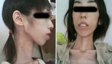 شکنجه دختر ژاپنی با کاهش وزن! +عکس