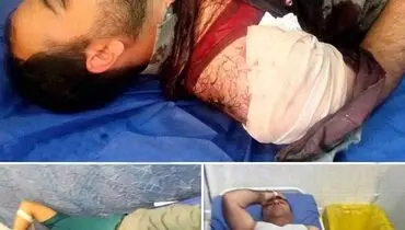 شلیک صیادان به ۳ محیط بان +عکس