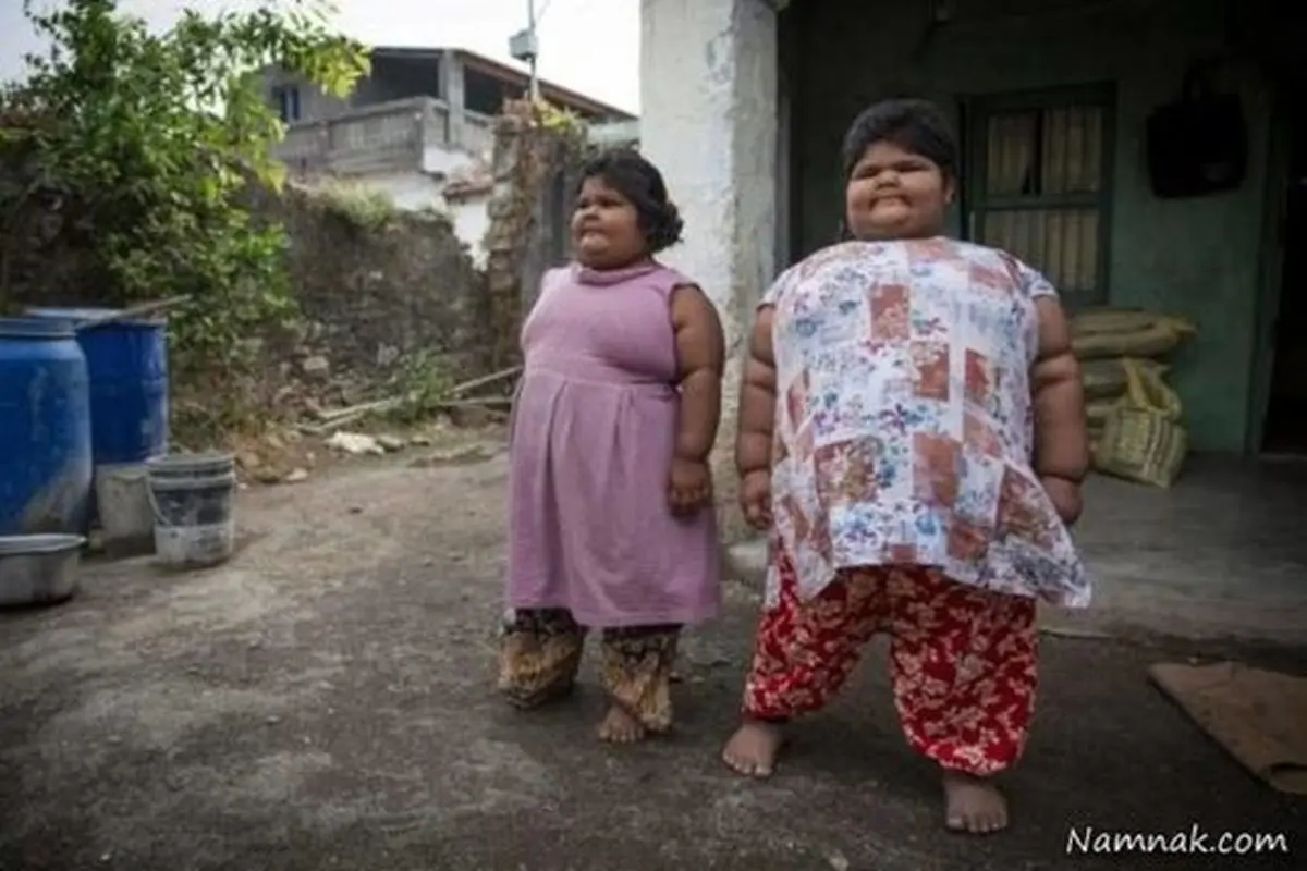 چاق‌ترین خواهران دنیا با گرسنگی وحشتناک +تصاویر