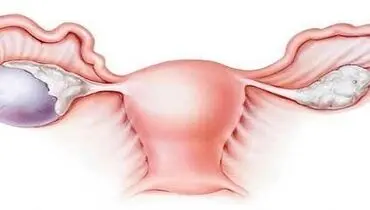 دلیل انجام آزمایش HPV چیست؟