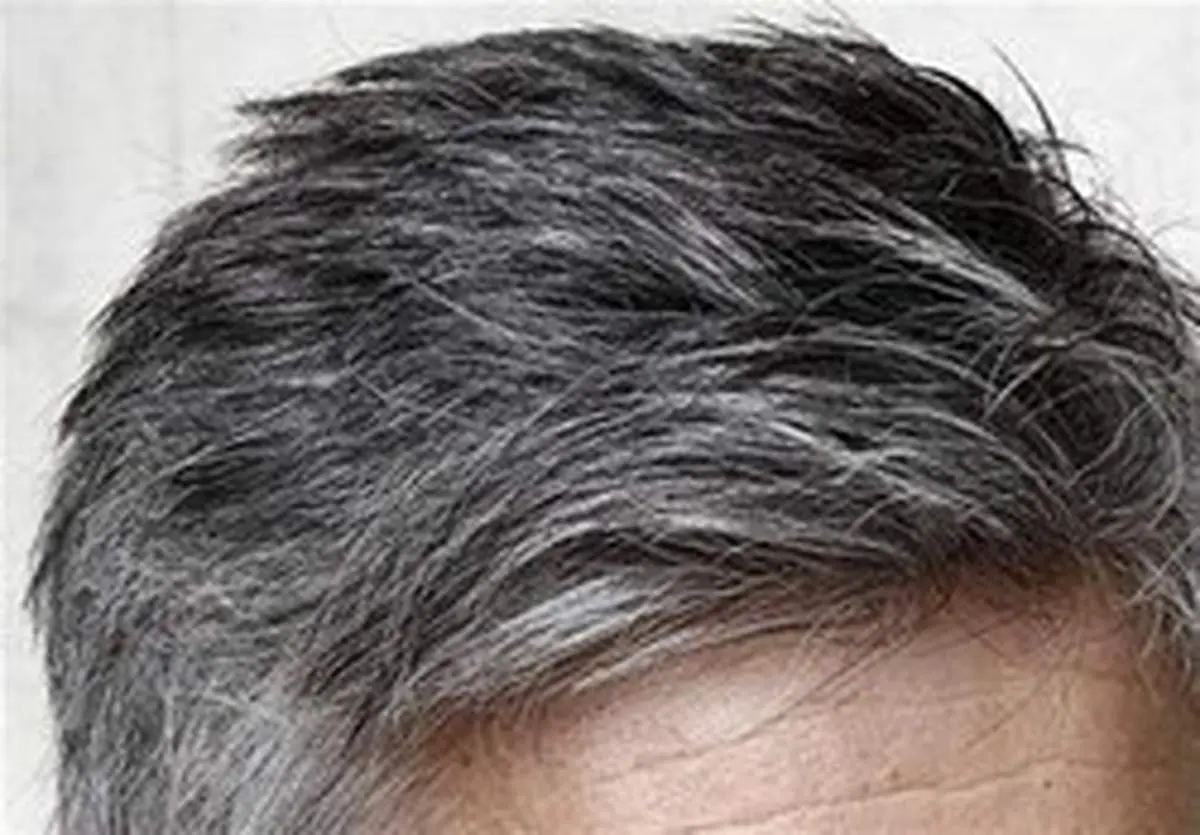راهکار طب سنتی برای جلوگیری از سفیدی زودرس موها