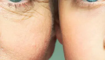 ۹ مرحله برای جلوگیری از پیری زودرس در زنان