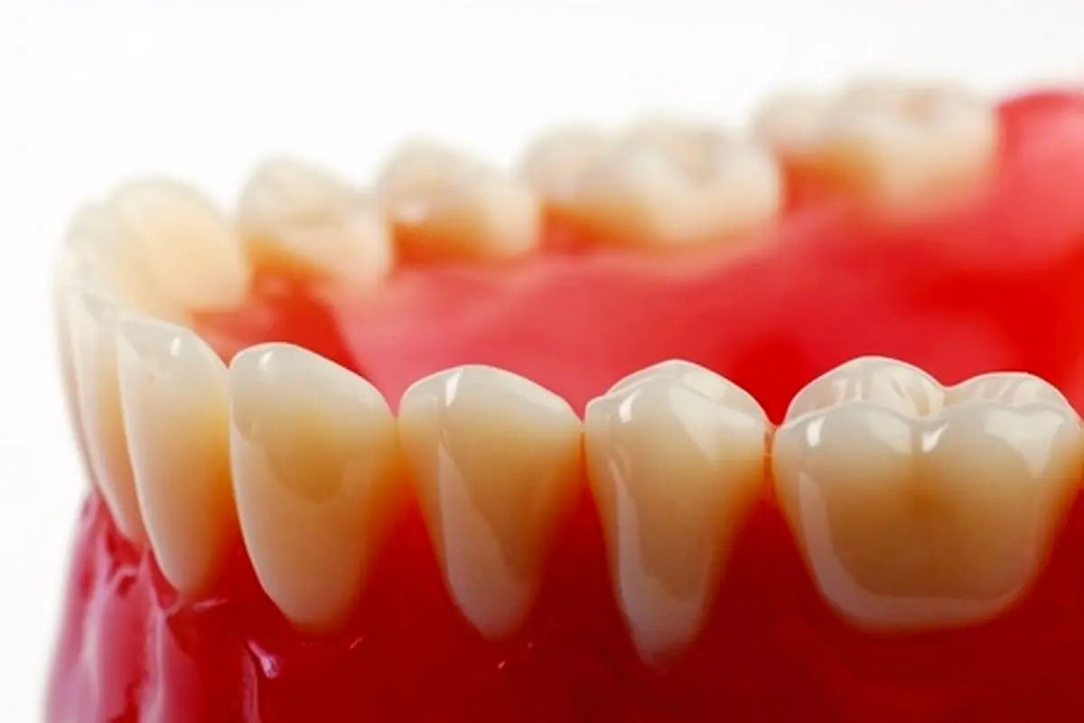 علت لکه سفید روی دندان چیست؟ +راه‌هایی برای درمان