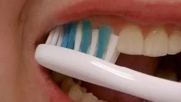 بعد از خوردن ترشی مسواک زدن ممنوع