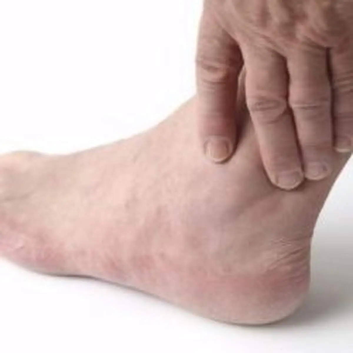 چند درمان خانگی برای رهایی از شر بیماری نقرس