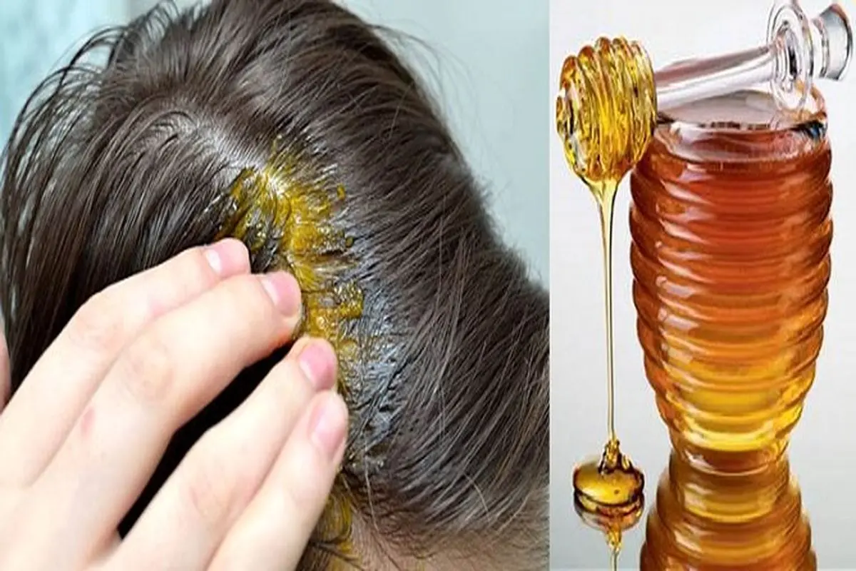با استفاده از عسل مانع ریزش موهایتان شوید