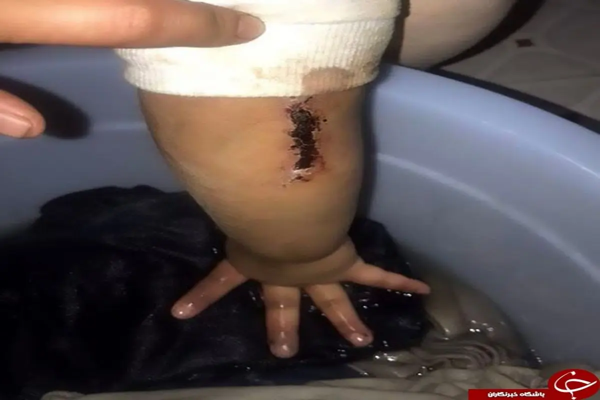 شکنجه وحشتناک دختر خردسال توسط پدرش +تصاویر