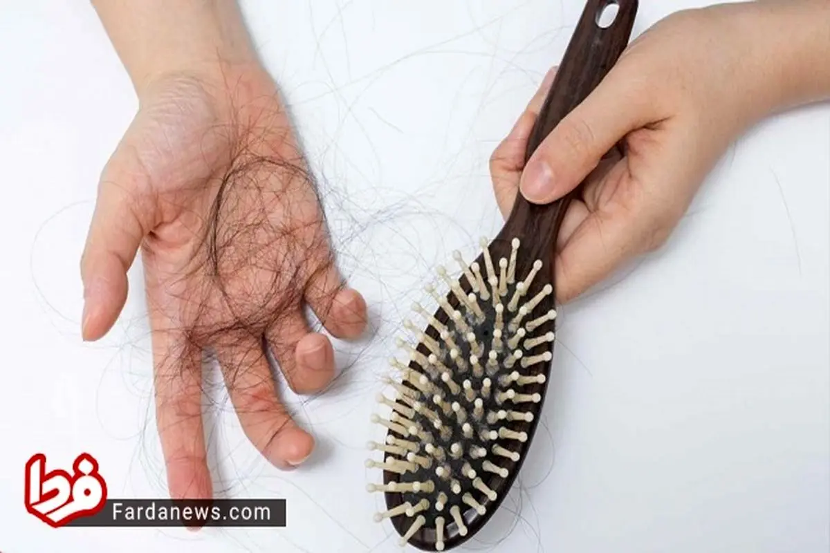۱۲ درمان قطعی برای ریزش مو در زنان