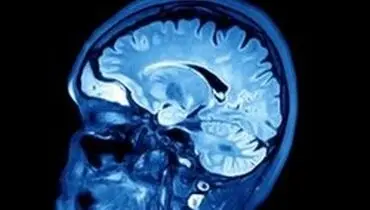 نقش ویروس «هرپس» در بیماری آلزایمر
