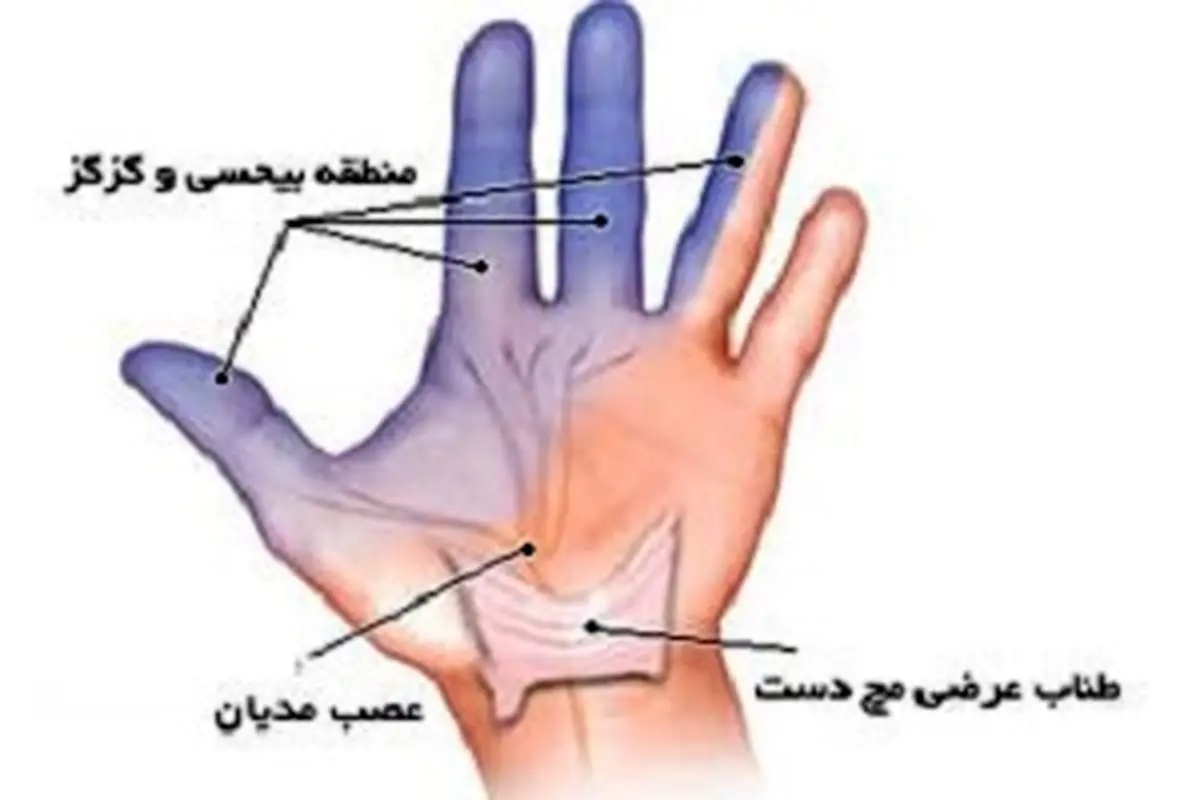 علت ایجاد گزگز دست و روشهای درمان آن