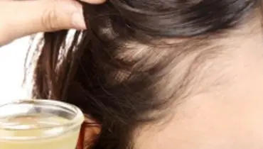 درمان ریزش مو به کمک آب پیاز