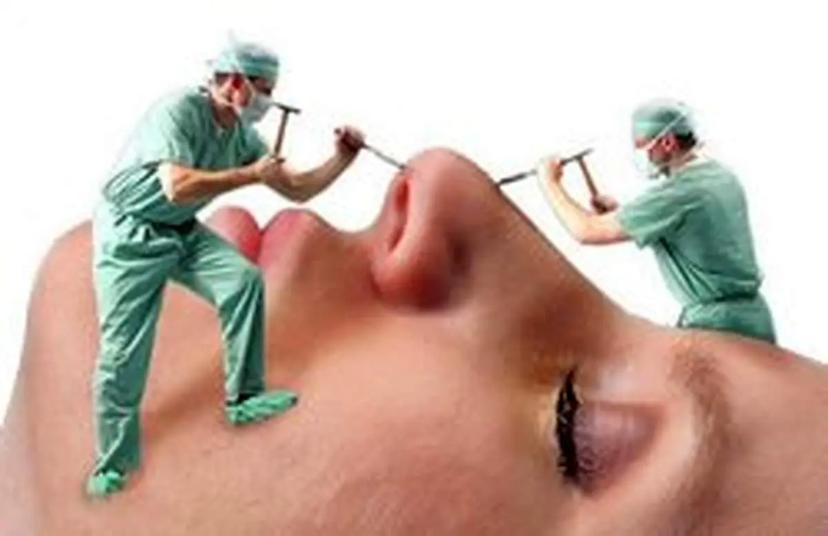 چرایی اعمال جراحی ناموفق بینی و اختلاف قیمت‌ها