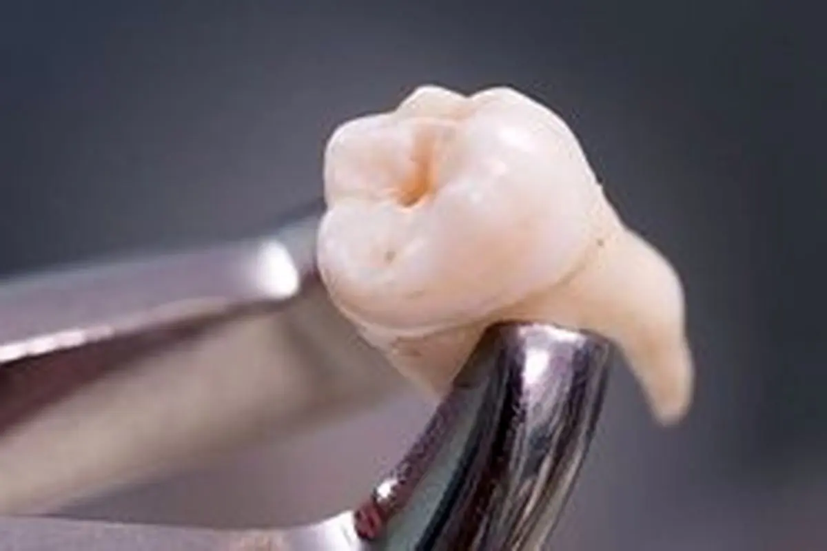 وضعیت دندان ها در زمان جویدن چگونه است