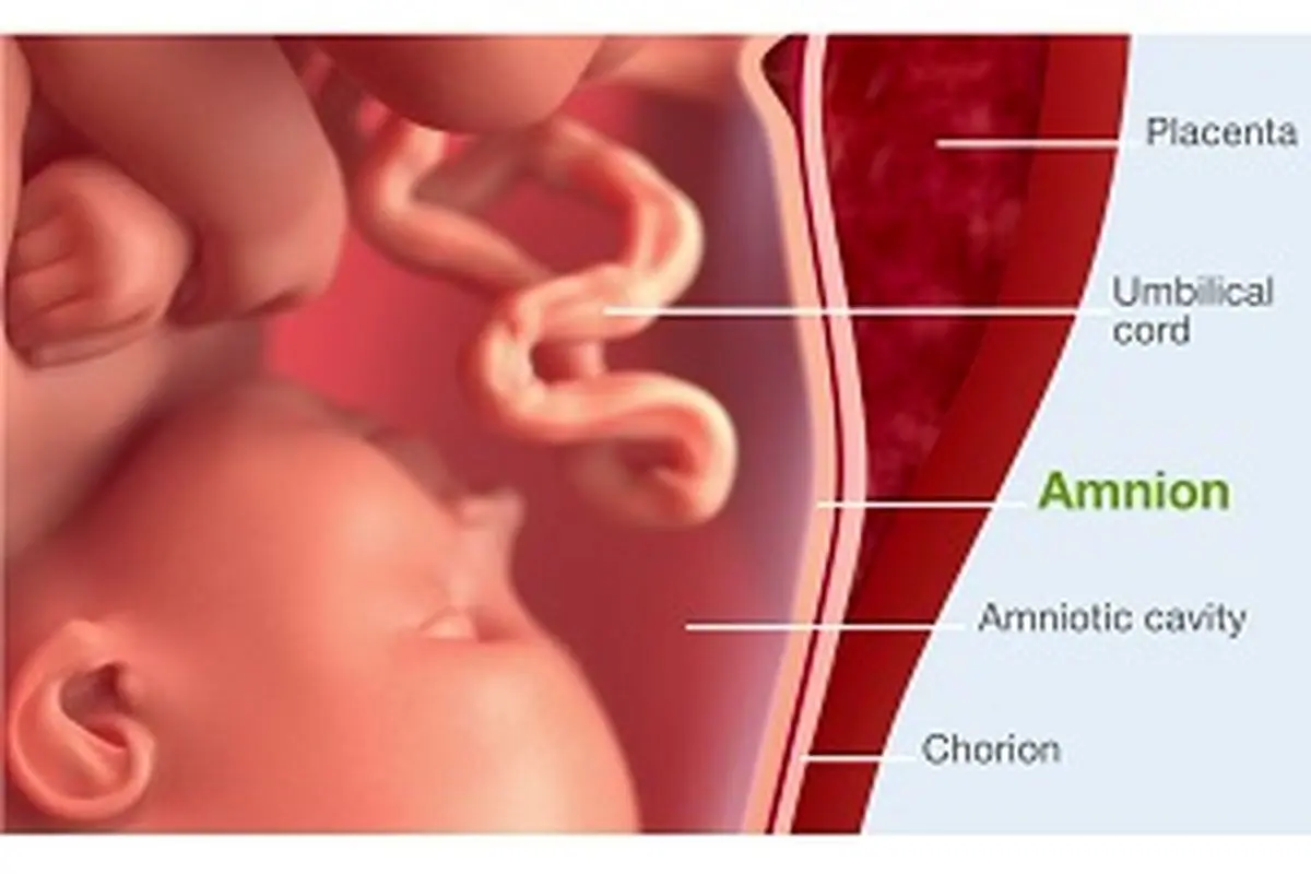 پرده آمنیوتیک Amniotic membrane چه کاربردهایی دارد؟