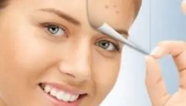 ۸ روش فوق العاده برای رهایی از شر لکه‌های تیره روی پوست