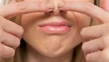 چگونه جوش های سر سیاه روی بینی را از بین ببریم؟