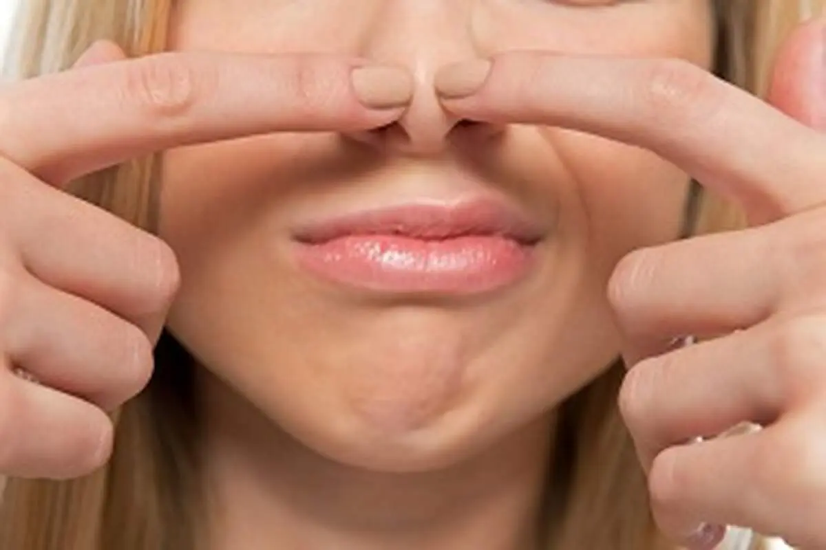 چگونه جوش های سر سیاه روی بینی را از بین ببریم؟