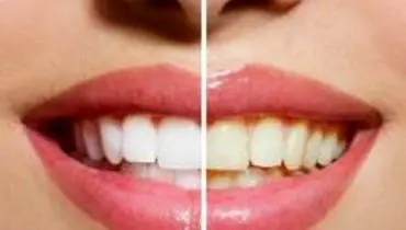 اهمیت بهداشت دندان