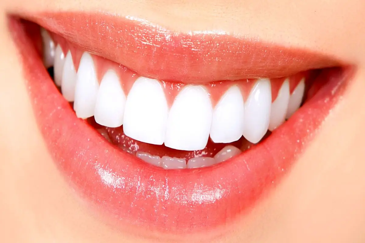 چگونه از زرد شدن دندان‌هایمان پیشگیری کنیم؟