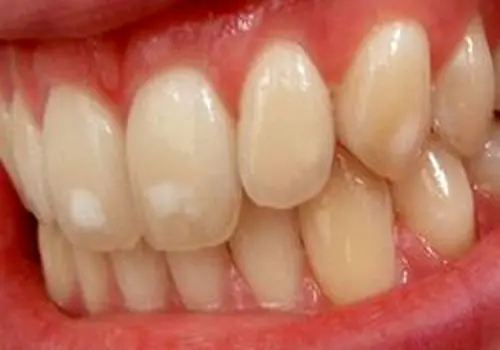 کشیدن دندان توسط طوطی دندانپزشک!+ فیلم