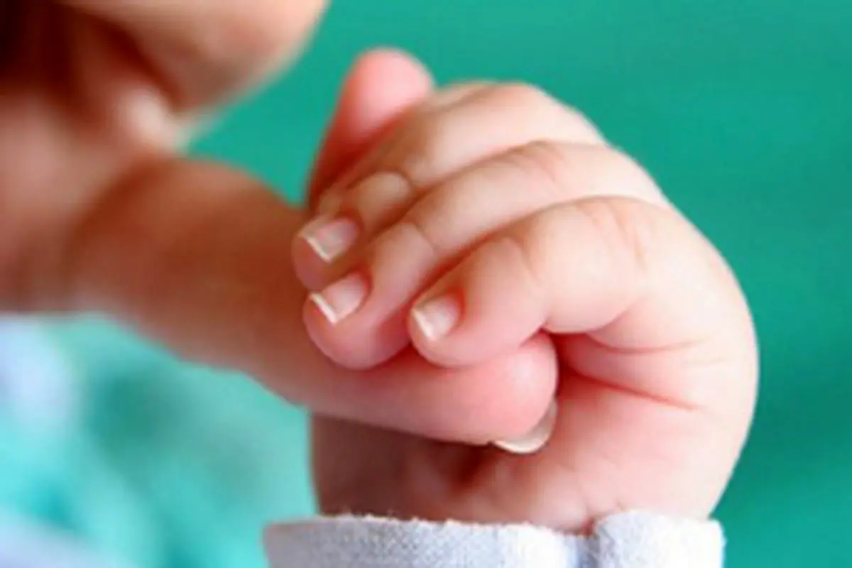نوزادی که با دو صورت و دو مغز متولد شد +عکس