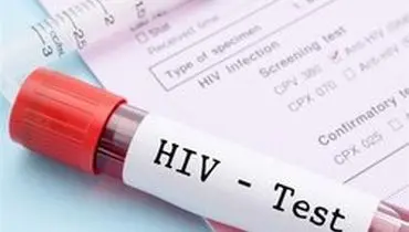 هشدار درباره "خشنودی خطرناک" در روند مقابله با ایدز