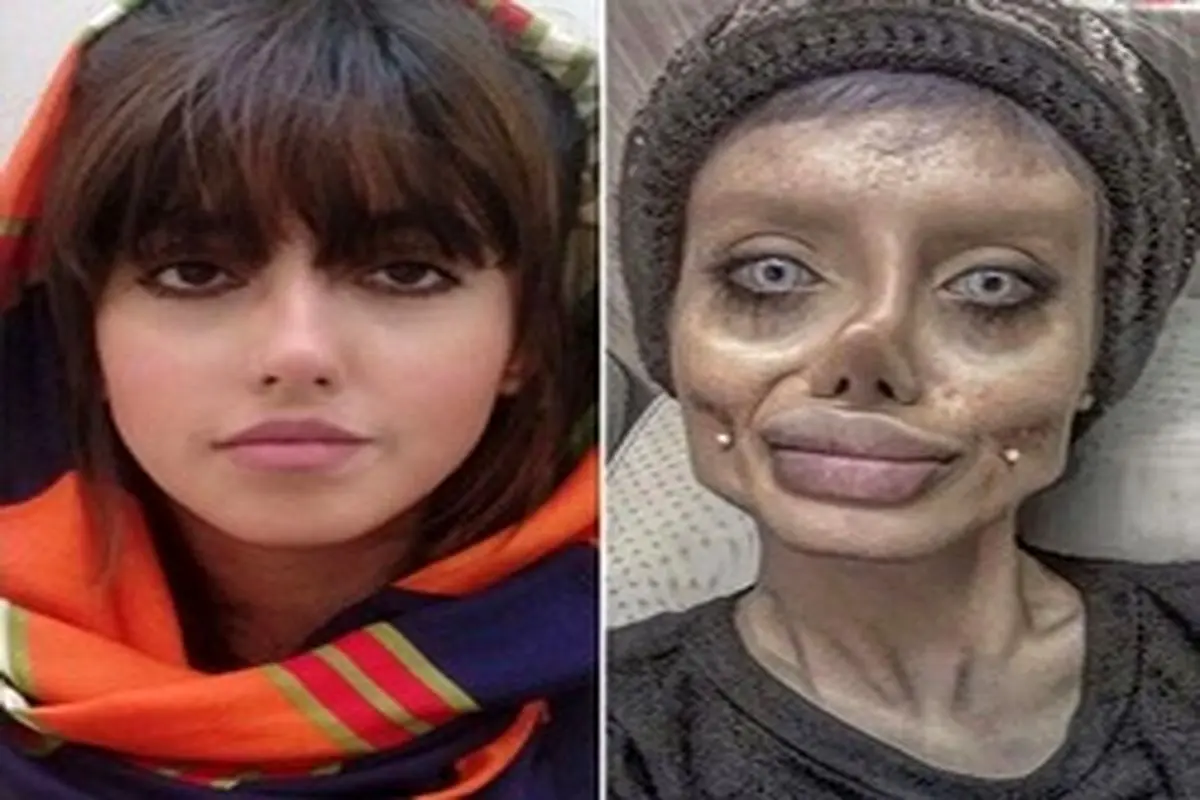 دختر ایرانی که شبیه «آنجلینا جولی» شد +عکس