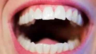 علت تلخی دهان چیست