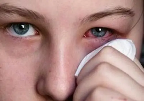 این علائم یعنی چشم ما در حال نابینا شدن است