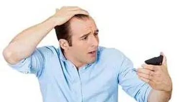 ۱۰ علت مهم ریزش مو