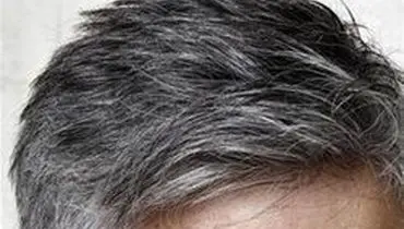 عامل اصلی سفید شدن مو‌ها چیست؟