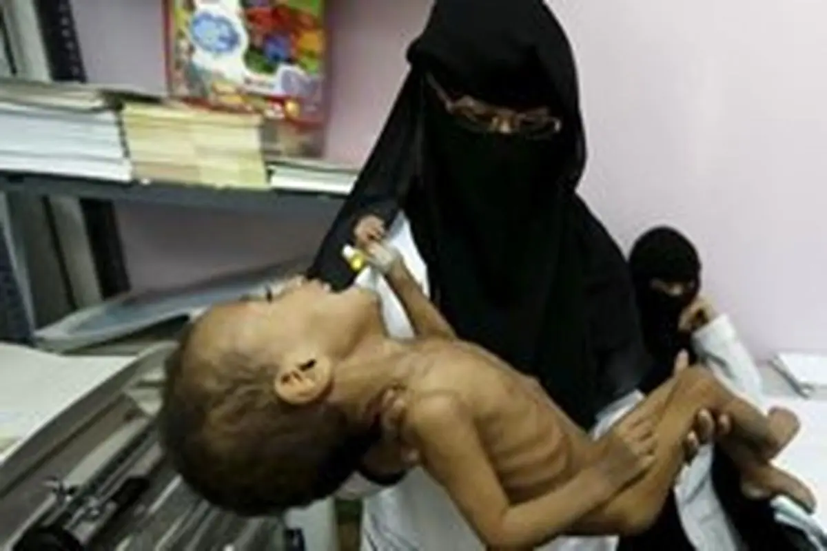 هشدار سازمان ملل درباره امنیت غذایی یمنی‌ها