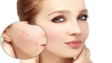 چگونه از پوست خود در برابر استرس محافظت کنیم