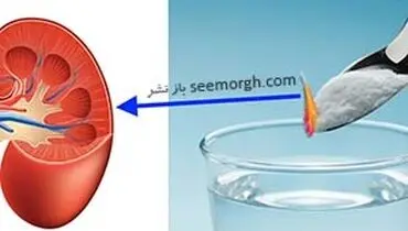 بهترین روش برای بهبود عملکرد کلیه ها